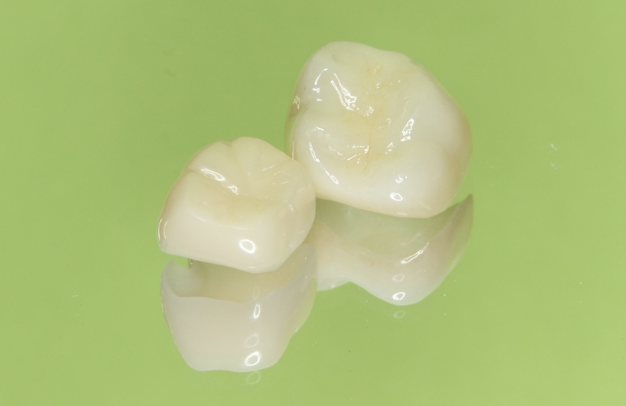 セラミック治療