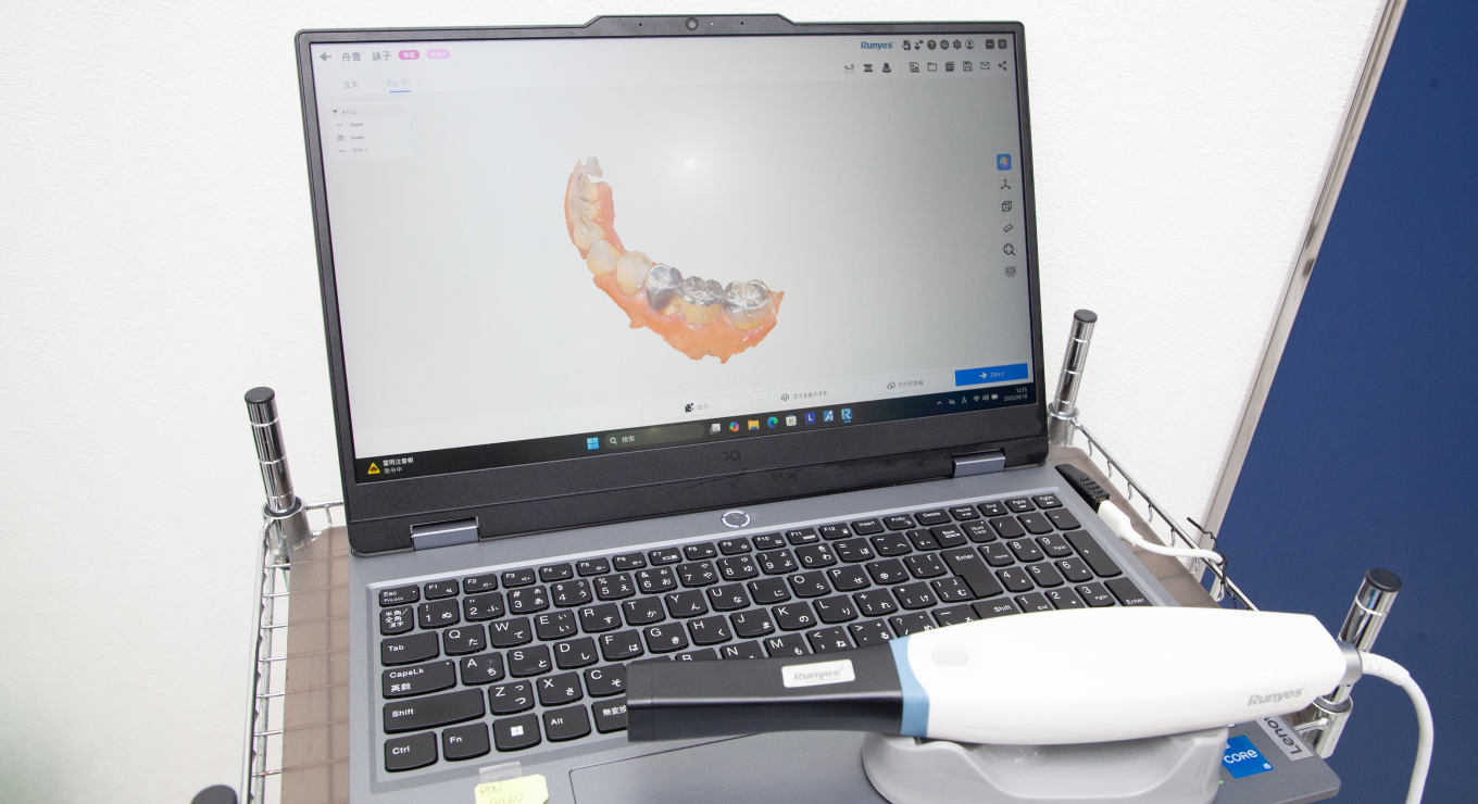 セラミック治療